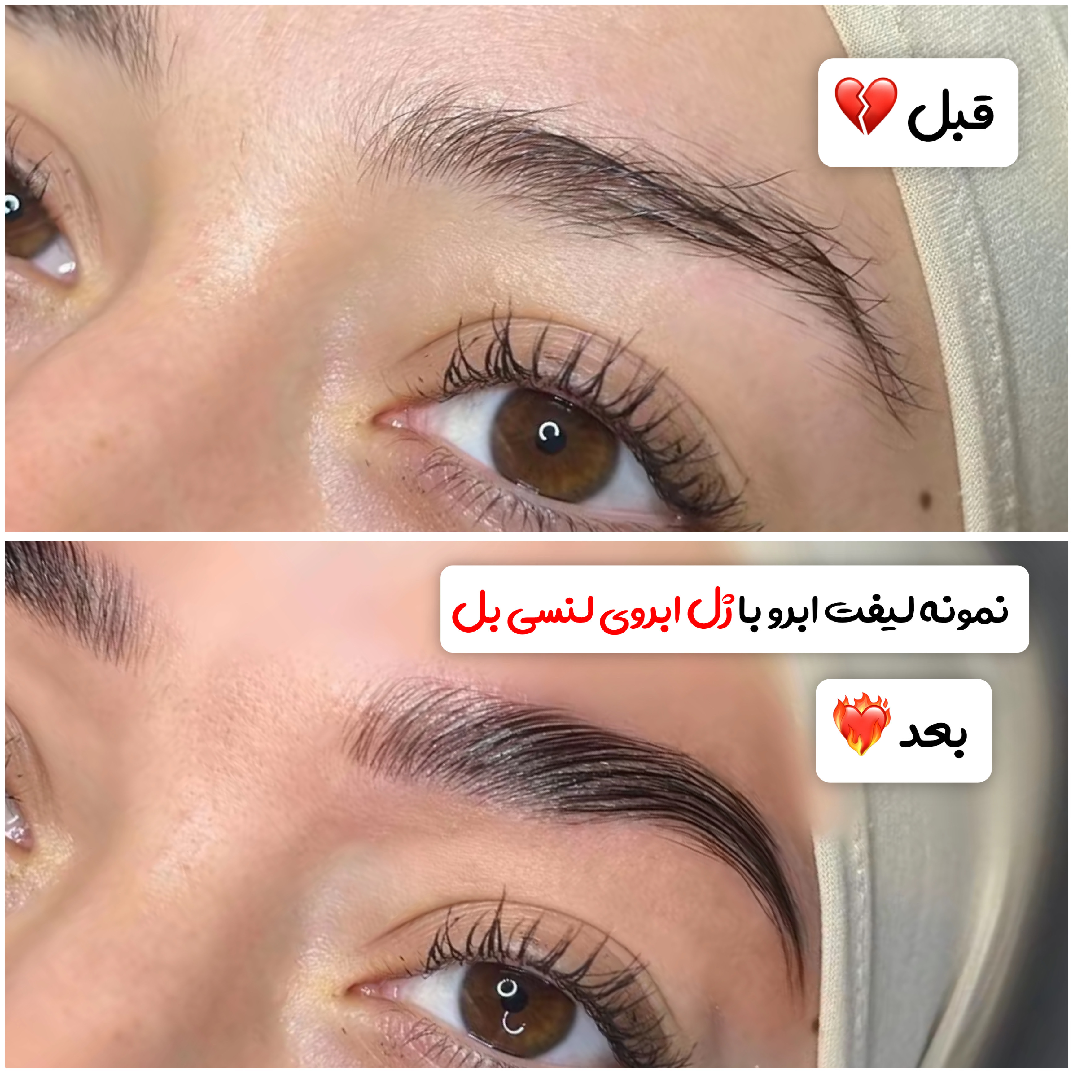 ژل لیفت ابروی لنسی بل