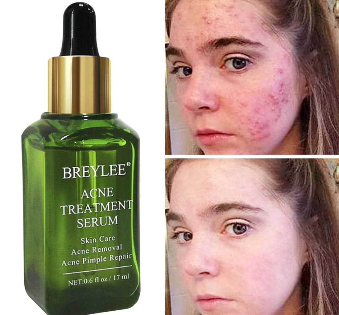 سرم چای سبز بریلی