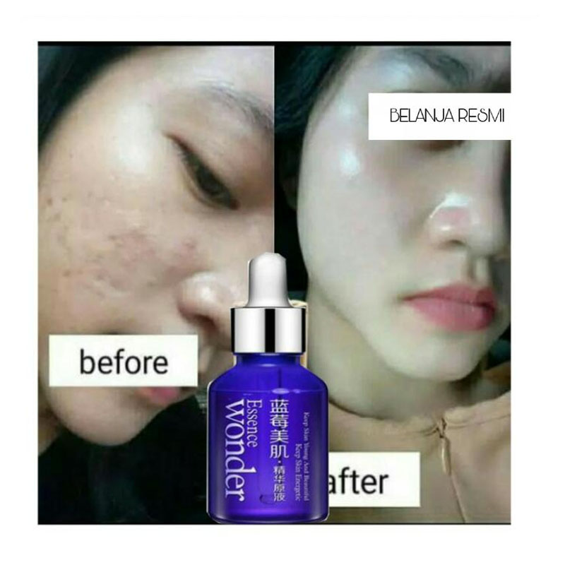 سرم بلوبری بیواکوا