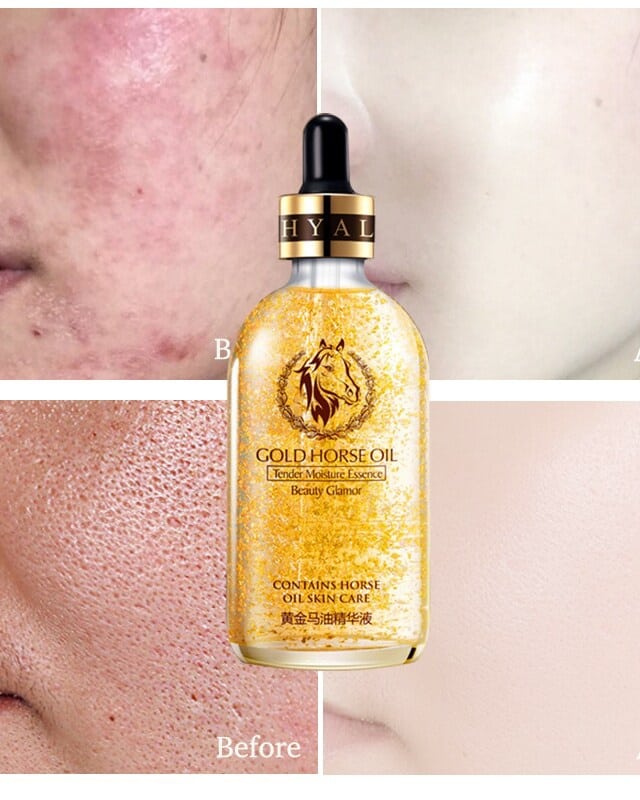 سرم اسب و طلای24کا ایمیجز