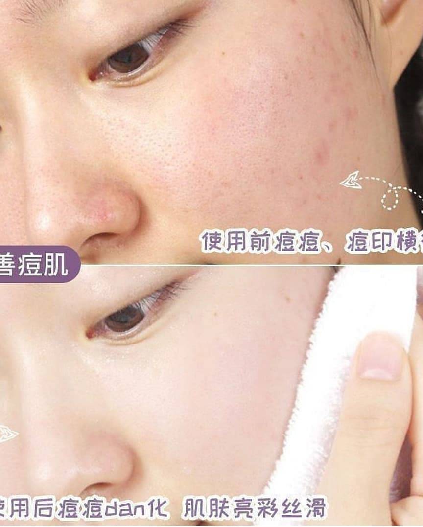 ماسک استیکی بادمجان