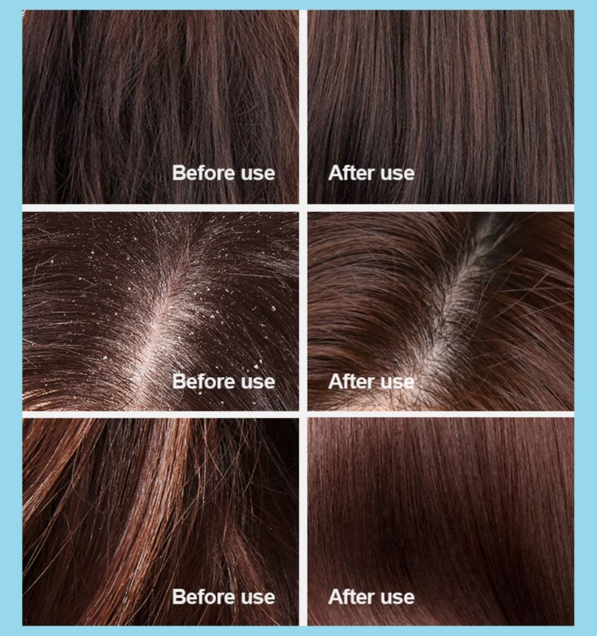 شامپو ضدریزش بیواکوا