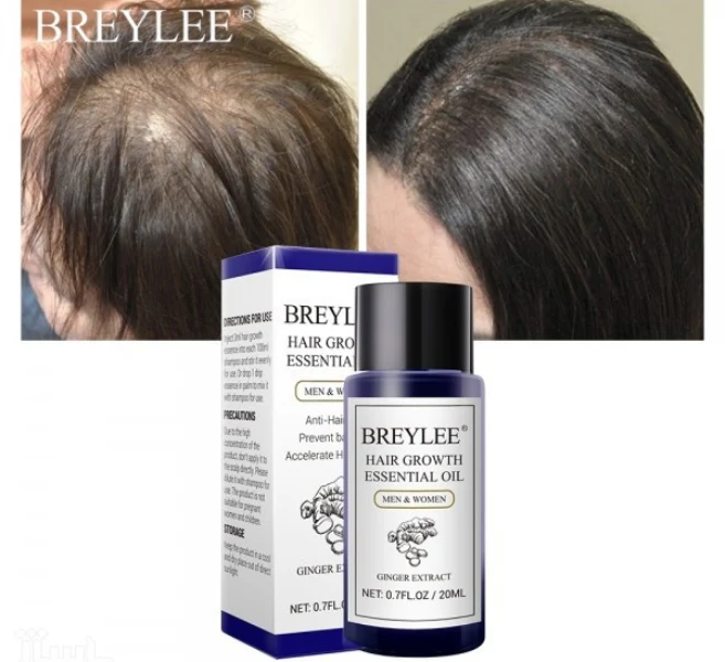 سرم ضدریزش بریلی